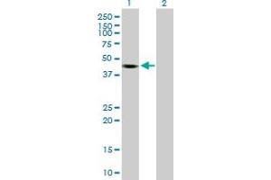 Western Blot analysis of KCTD18 expression in transfected 293T cell line by KCTD18 MaxPab polyclonal antibody. (KCTD18 抗体  (AA 1-426))