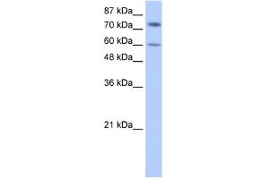 WB Suggested Anti-IGF2BP1 Antibody Titration:  0. (IGF2BP1 抗体  (N-Term))