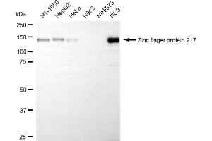 Western blotting analysis using zinc finger protein 217 antibody (ABIN7800894). (Recombinant ZNF217 抗体)
