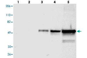 Western blot analysis of Lane 1: RT-4, Lane 2: U-251 MG, Lane 3: A-431, Lane 4: Liver, Lane 5: Tonsil with FGB polyclonal antibody . (Fibrinogen beta Chain 抗体)