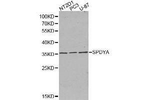 Western blot analysis of extracts of various cell lines, using SPDYA antibody. (SPDYA 抗体  (AA 1-313))