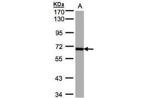 WB Image Sample(30 ug whole cell lysate) A:Raji , 7. (PLK1 抗体)