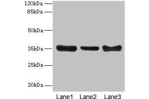 Western blot All lanes: ZNF625 antibody at 4 μg/mL Lane 1: Mouse brain tissue Lane 2: Mouse lung tissue Lane 3: Mouse ovarian tissue Secondary Goat polyclonal to rabbit IgG at 1/10000 dilution Predicted band size: 35, 43 kDa Observed band size: 35 kDa (ZNF625 抗体  (AA 1-306))
