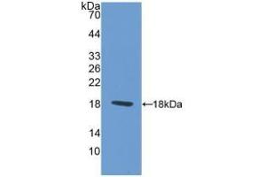 Detection of Recombinant PAX6, Rat using Polyclonal Antibody to Paired Box Gene 6 (PAX6) (PAX6 抗体  (AA 1-130))
