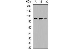 Western blot analysis of VPS35 expression in Hela (A), HepG2 (B), Raji (C) whole cell lysates. (VPS35 抗体)