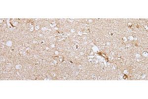 Immunohistochemistry of paraffin-embedded Human brain tissue using HOXC9 Polyclonal Antibody at dilution of 1:35(x200) (HOXC9 抗体)