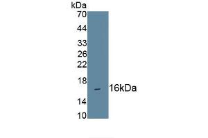 Detection of Recombinant CD160, Human using Monoclonal Antibody to Cluster Of Differentiation 160 (CD160) (CD160 抗体  (AA 37-154))