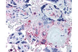Anti-ADAMTS5 antibody IHC of human placenta. (ADAMTS5 抗体  (Internal Region))