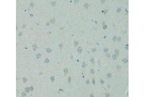 Immunohistochemistry of paraffin-embedded Rat brain using SMAD6 Polyclonal Antibody at dilution of 1:100 (40x lens). (SMAD6 抗体)
