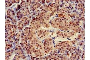 Immunohistochemistry of paraffin-embedded human pancreatic tissue using ABIN7173455 at dilution of 1:100 (TRIM5 抗体  (AA 1-493))