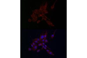 Immunofluorescence analysis of PC-12 cells using MMP2 antibody (ABIN6129301, ABIN6143911, ABIN6143913 and ABIN6221846) at dilution of 1:100. (MMP2 抗体  (AA 40-280))