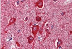 Human Brain, Cortex (formalin-fixed, paraffin-embedded) stained with CYCS antibody ABIN462359 followed by biotinylated anti-mouse IgG secondary antibody ABIN481714, alkaline phosphatase-streptavidin and chromogen. (Cytochrome C 抗体)