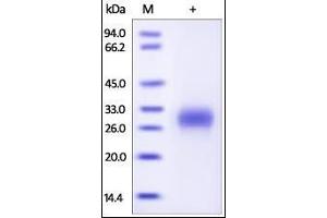SDS-PAGE (SDS) image for Placenta Growth Factor (PGF) (AA 19-170) (Active) protein (His tag) (ABIN2181647)