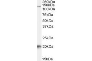 Western Blotting (WB) image for anti-HIV-1 Tat Specific Factor 1 (HTATSF1) (AA 19-33) antibody (ABIN297173) (HTATSF1 抗体  (AA 19-33))