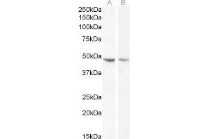 Western Blotting (WB) image for anti-serpin Peptidase Inhibitor, Clade I (neuroserpin), Member 1 (SERPINI1) (C-Term) antibody (ABIN185373)