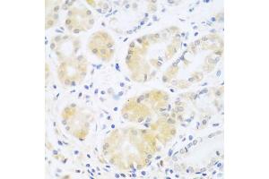 Immunohistochemistry of paraffin-embedded human stomach using C5 antibody (ABIN5974486) at dilution of 1/100 (40x lens).