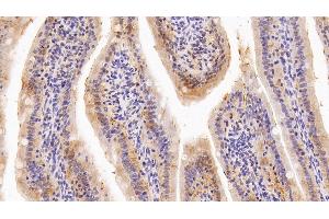 Detection of GAL4 in Rat Small intestine Tissue using Polyclonal Antibody to Galectin 4 (GAL4) (GAL4 抗体  (AA 1-323))