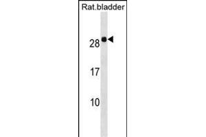 Rat Hoxb7 Antibody (Center) (ABIN1538488 and ABIN2849957) western blot analysis in Rat bladder tissue lysates (35 μg/lane). (HOXB7 抗体  (AA 56-83))