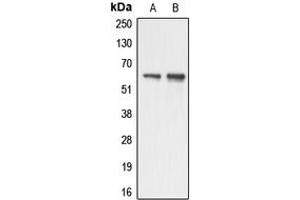 Western Blotting (WB) image for anti-Apoptosis Antagonizing Transcription Factor (AATF) (N-Term) antibody (ABIN7298044)