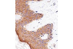 Immunohistochemical analysis of paraffin-embedded H. (BLMH 抗体  (AA 212-242))