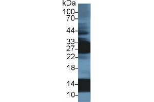 Detection of HBa1 in Human Liver lysate using Polyclonal Antibody to Hemoglobin Alpha 1 (HBa1)