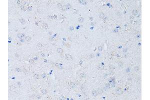 Immunohistochemistry of paraffin-embedded mouse brain using RYR2 Antibody (ABIN5970123) at dilution of 1/100 (40x lens). (RYR2 抗体)