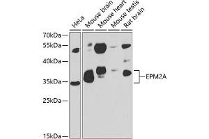 Western blot analysis of extracts of various cell lines, using EPM2A antibody (ABIN6131609, ABIN6140229, ABIN6140230 and ABIN6222778) at 1:1000 dilution. (EPM2A 抗体  (AA 244-331))