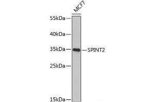 Western blot analysis of extracts of MCF-7 cells using SPINT2 Polyclonal Antibody at dilution of 1:1000. (SPINT2 抗体)