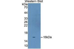 Western blot analysis of the recombinant protein. (Fibronectin 抗体  (AA 2206-2337))