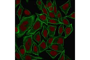 Immunofluorescence (IF) image for anti-Spectrin, Beta, Non-erythrocytic 2 (SPTBN2) (AA 356-475) antibody (ABIN6940653)