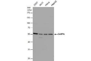 WB Image GABPA antibody detects GABPA protein by western blot analysis. (GABPA 抗体  (Internal Region))