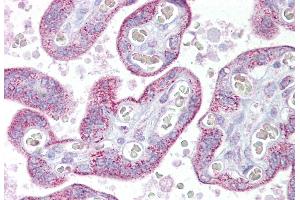 Immunohistochemistry (IHC) image for anti-Transient Receptor Potential Cation Channel, Subfamily C, Member 4 (TRPC4) (Middle Region) antibody (ABIN2776213)