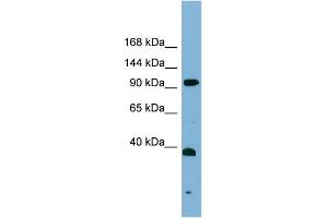 Western Blotting (WB) image for anti-Excision Repair Cross-Complementing Rodent Repair Deficiency, Complementation Group 4 (ERCC4) (Middle Region) antibody (ABIN2787618)