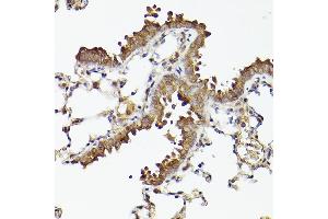 Immunohistochemistry of paraffin-embedded mouse lung using  Rabbit mAb (ABIN7265788) at dilution of 1:100 (40x lens). (ATG12 抗体)