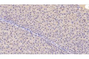 Detection of CHEM in Human Liver Tissue using Monoclonal Antibody to Chemerin (CHEM) (Chemerin 抗体  (AA 33-158))