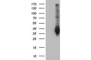 Western Blotting (WB) image for anti-Family with Sequence Similarity 84, Member B (FAM84B) antibody (ABIN1498212) (FAM84B 抗体)