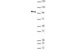 CHD3 antibody (rAb) tested by Western blot. (Recombinant CHD3 抗体  (AA 865-885))