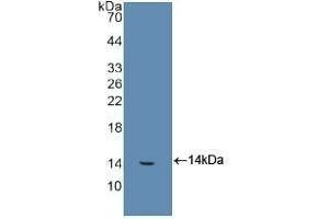 Detection of Recombinant FGb, Human using Polyclonal Antibody to Fibrinogen Beta Chain (FGB) (Fibrinogen beta Chain 抗体  (AA 29-118))