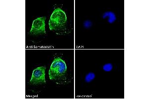 ABIN7013881 Immunofluorescence analysis of paraformaldehyde fixed U251 cells, permeabilized with 0. (Somatostatin 抗体  (AA 58-70))