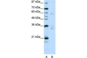 Western Blotting (WB) image for anti-Zinc Finger Protein 440 (ZNF440) antibody (ABIN2461986) (ZNF440 抗体)