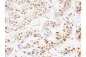 Immunohistochemistry (IHC) image for anti-PHD Finger Protein 8 (PHF8) (AA 650-700) antibody (ABIN7448725) (PHF8 抗体  (AA 650-700))