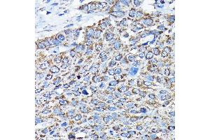 Immunohistochemistry (IHC) image for anti-Electron-Transfer-Flavoprotein, alpha Polypeptide (ETFA) (AA 1-333) antibody (ABIN6140315)