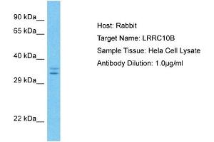 Host: Rabbit Target Name: LRRC10B Sample Type: Hela Whole Cell lysates Antibody Dilution: 1. (LRRC10B 抗体  (C-Term))