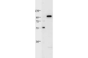 Western Blotting (WB) image for anti-Signal Transducer and Activator of Transcription 2, 113kDa (STAT2) (C-Term) antibody (ABIN964699)