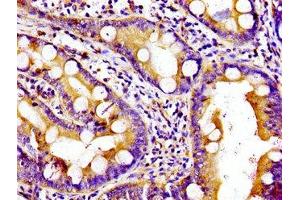 Immunohistochemistry of paraffin-embedded human small intestine tissue using ABIN7157571 at dilution of 1:100 (KIF5B 抗体  (AA 338-514))