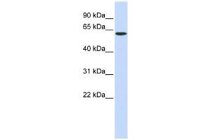 SPTLC1 antibody used at 1 ug/ml to detect target protein. (SPTLC1 抗体  (Middle Region))