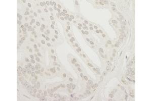 Immunohistochemistry (IHC) image for anti-Ubiquitin Specific Peptidase 37 (USP37) (C-Term) antibody (ABIN7448856)