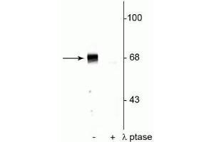 Western blot of rat hippocampal lysate showing specific immunolabeling of the ~68 kDa to ~70 kDa PAK protein phosphorylated at Ser402 in the first lane (-). (PAK1 抗体  (pThr402))