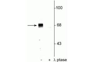Western blot of rat hippocampal lysate showing specific immunolabeling of the ~68 kDa to ~70 kDa PAK protein phosphorylated at Ser402 in the first lane (-). (PAK1-3 (pThr402) 抗体)
