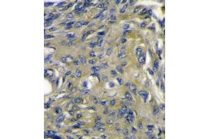 VEGFD (VEGF4) Antibody immunohistochemistry analysis in formalin fixed and paraffin embedded mouse heart tissue followed by peroxidase conjugation of the secondary antibody and DAB staining. (VEGFD 抗体  (C-Term))